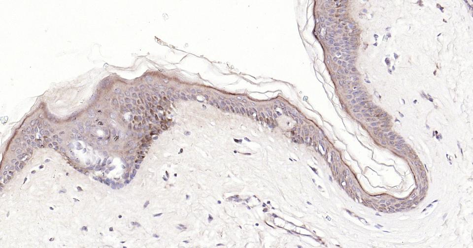 Bax重组兔单抗-bsm-52316R