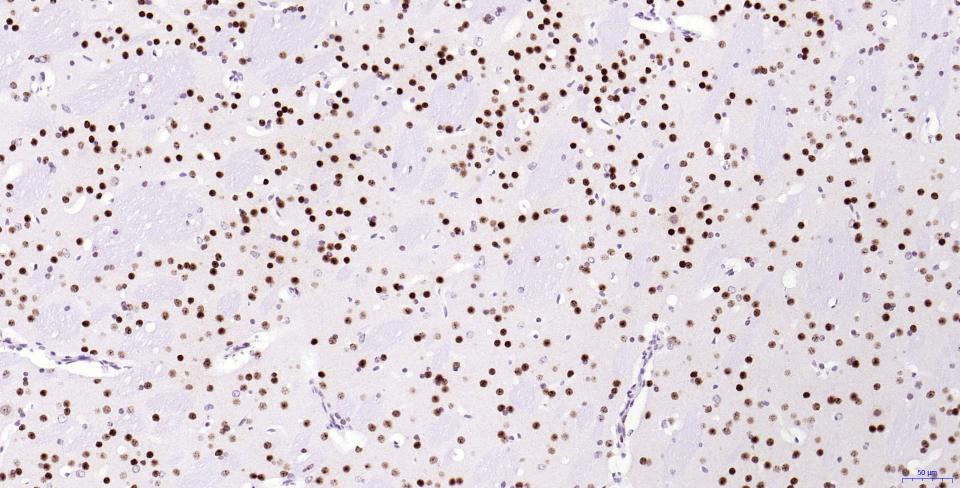 磷酸化组蛋白H2AX重组兔单抗-bsm-52163R