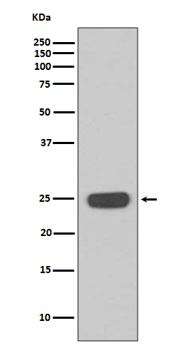 γ-干扰素/γ-IFN重组兔单抗-bsm-61406R