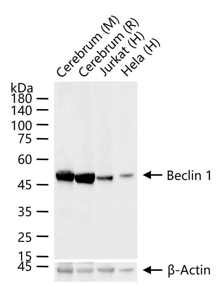 自噬效应蛋白Beclin 1重组兔单抗-bsm-61085R