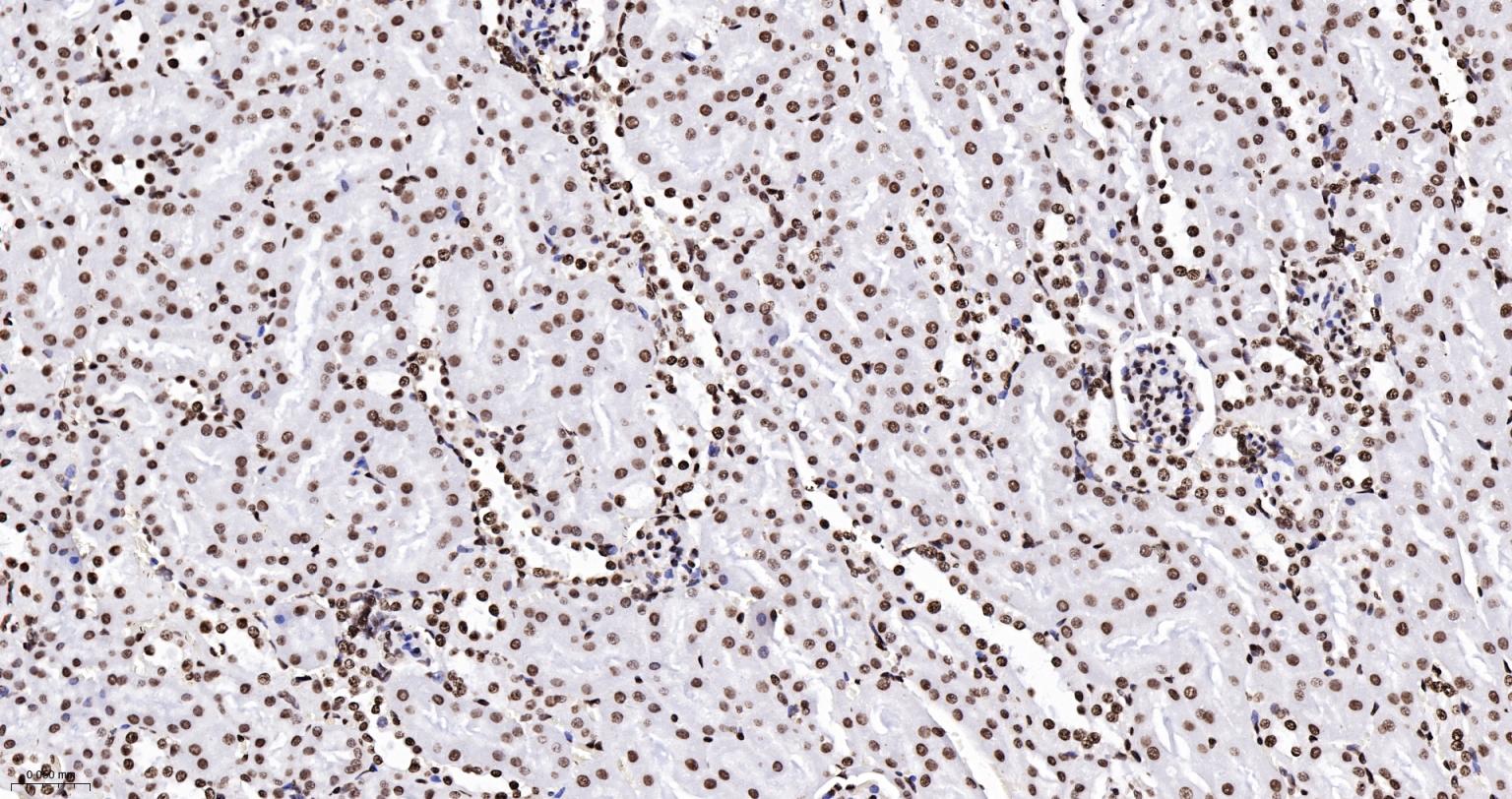 组蛋白H2AX重组兔单抗-bsm-61080R