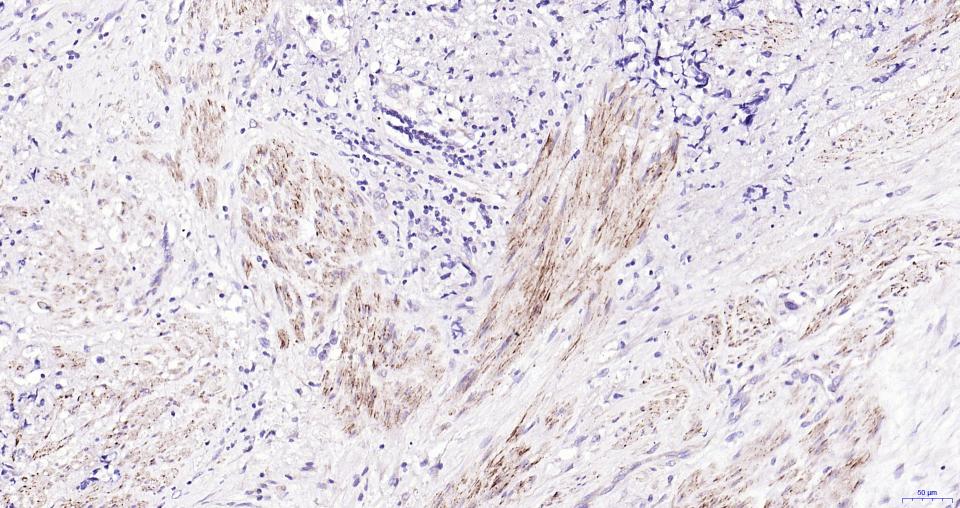 小鼠抗人CD56 (NCAM)单克隆抗体-bsm-30046M