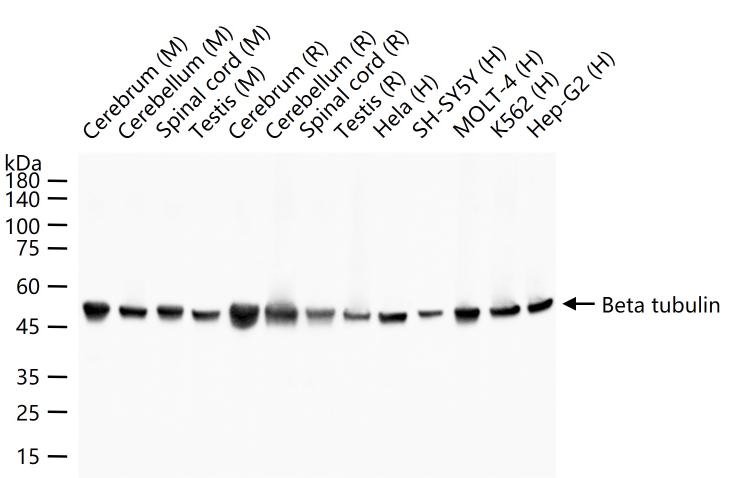 微管蛋白β tubulin/Tubulin β（内参）单克隆抗体-bsm-33034M