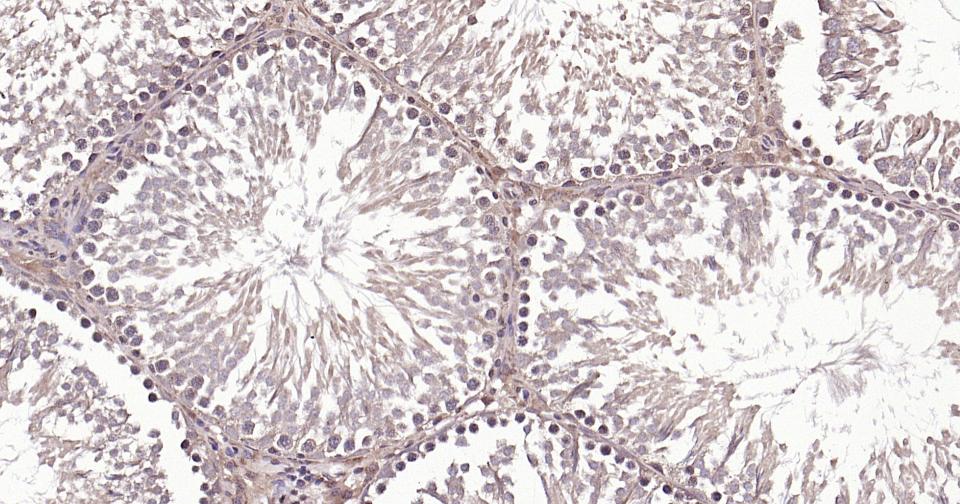 微管蛋白β tubulin/Tubulin β（内参）抗体-bs-4511R