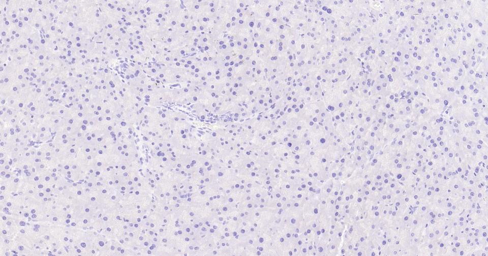 胶原蛋白17重组兔单抗-bsm-52041R