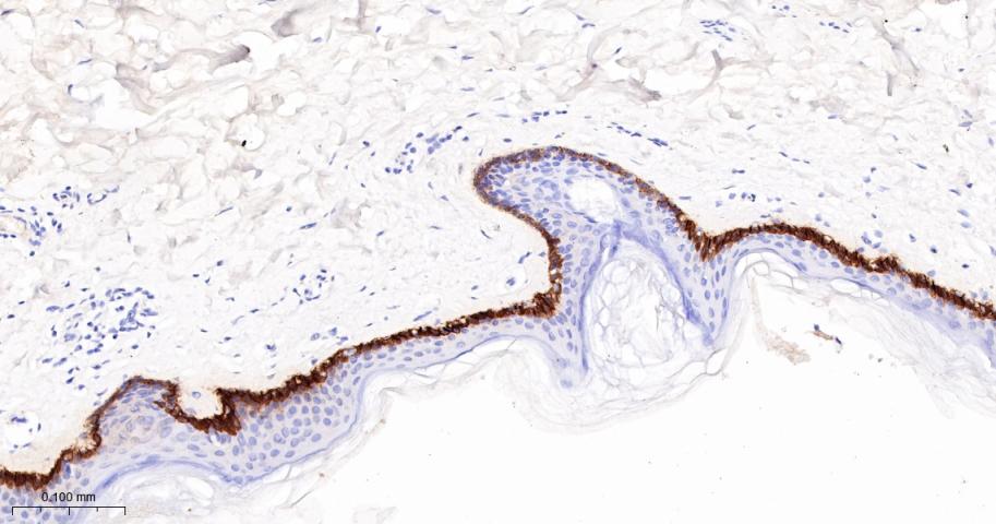 胶原蛋白17重组兔单抗-bsm-52041R