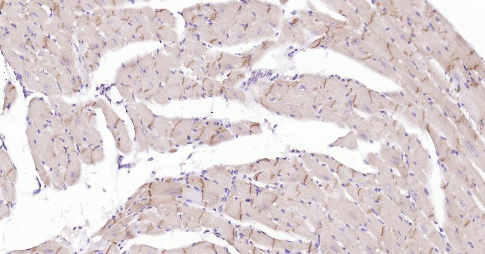 N-钙粘附分子重组兔单抗-bsm-52389R
