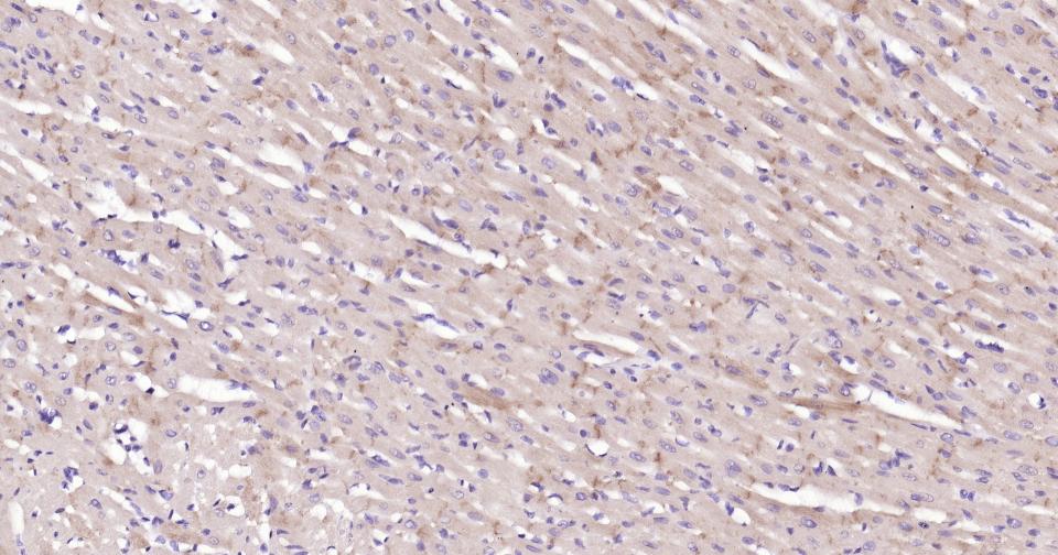 N-钙粘附分子重组兔单抗-bsm-52389R