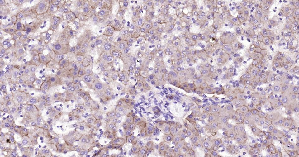 N-钙粘附分子重组兔单抗-bsm-52389R