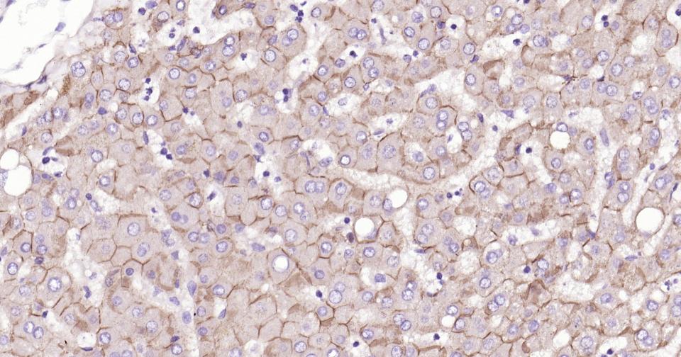 N-钙粘附分子重组兔单抗-bsm-52389R