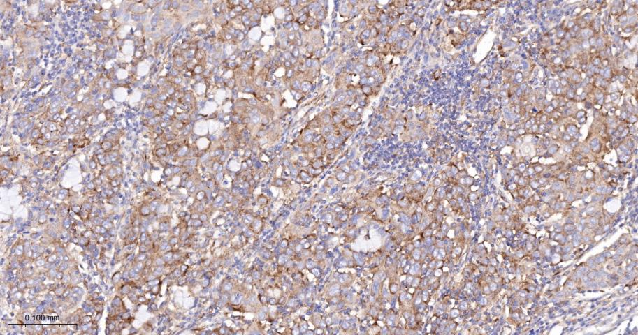 血管内皮生长因子受体1重组兔单抗-bsm-52338R