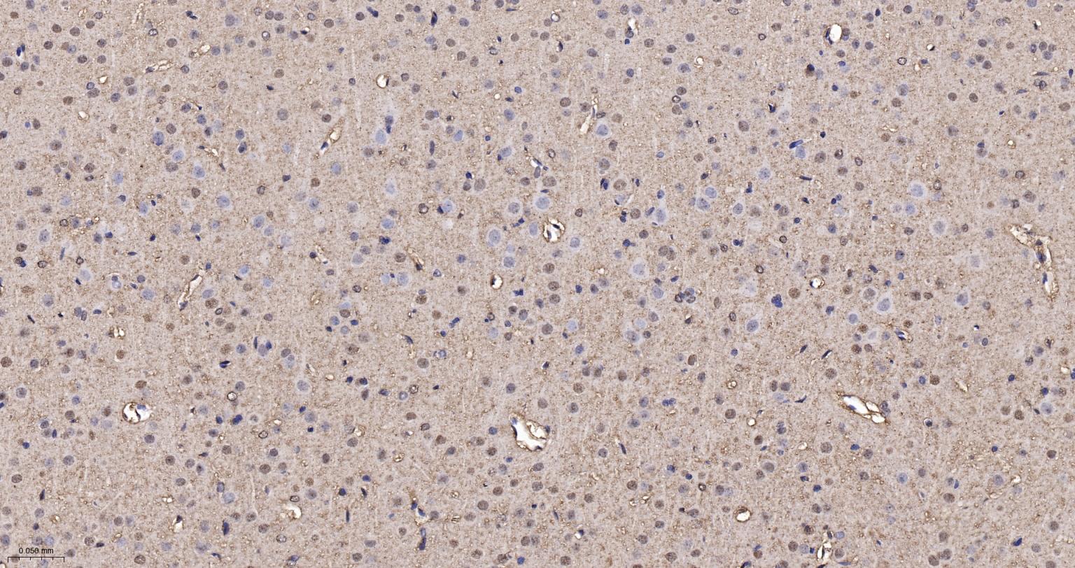 3-磷酸甘油醛脱氢酶（内参）重组兔单抗-bsm-52262R