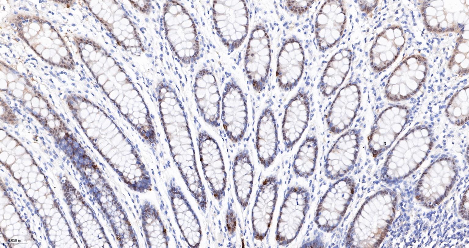Caspase-6重组兔单抗-bsm-52503R