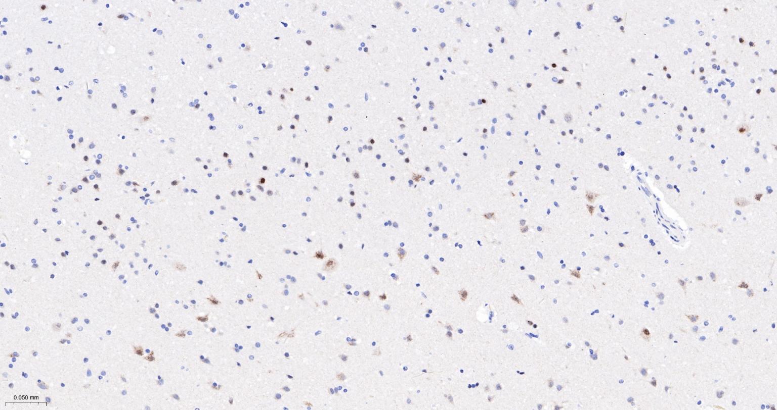 Caspase-6重组兔单抗-bsm-52503R