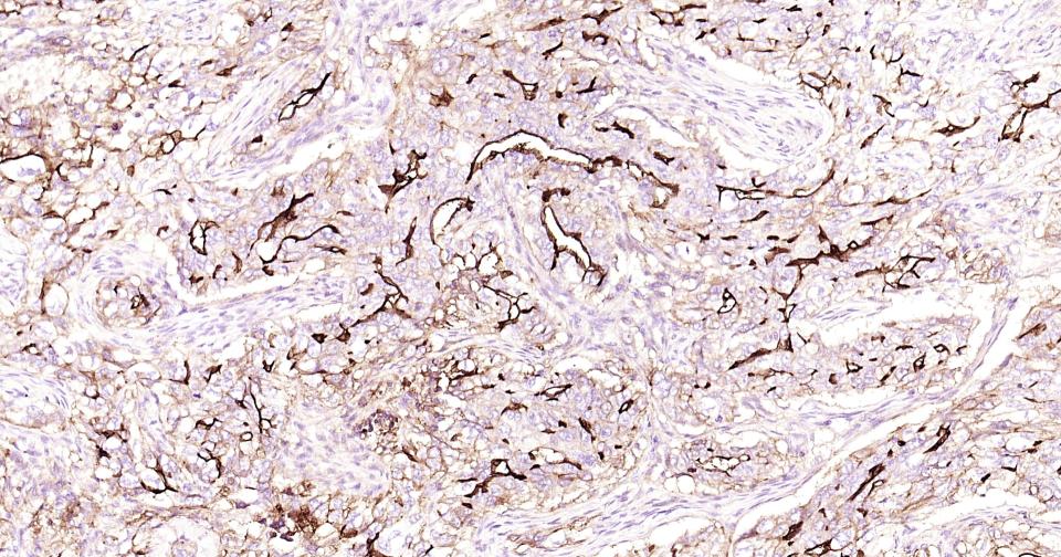 细胞间粘附分子-1（CD54）重组兔单抗-bsm-52466R