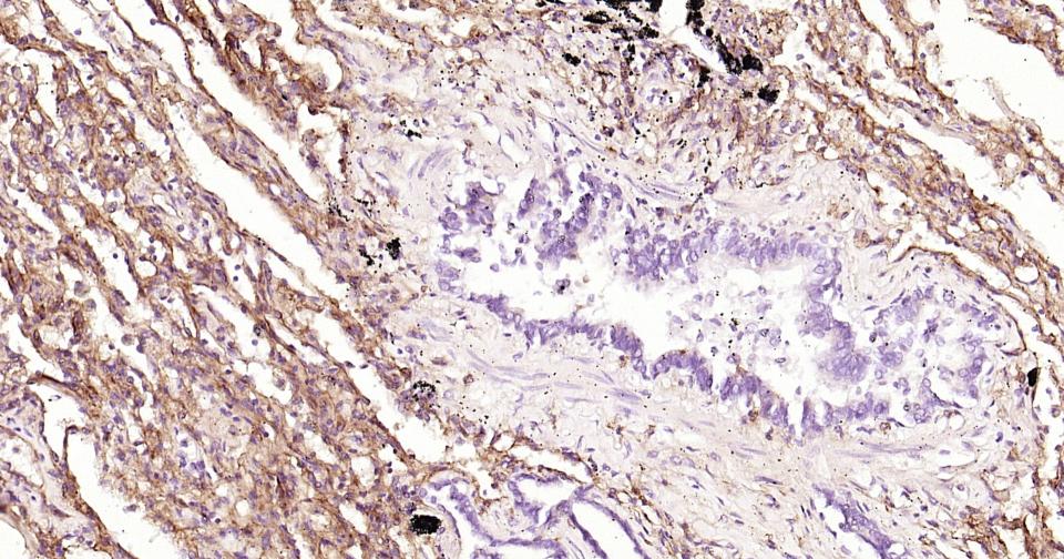 细胞间粘附分子-1（CD54）重组兔单抗-bsm-52466R