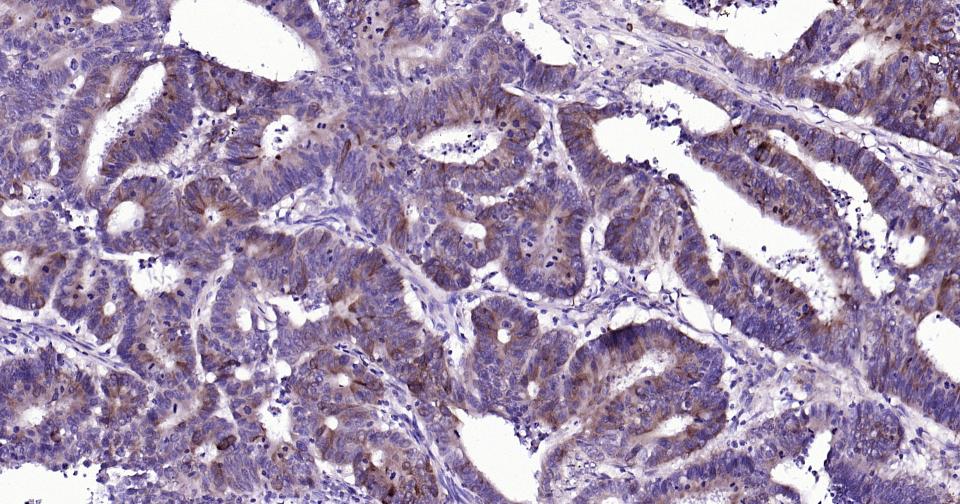 Caspase-9重组兔单抗-bsm-52566R