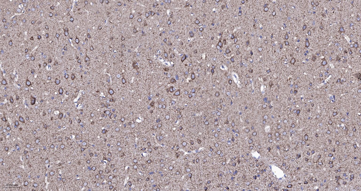 热休克蛋白-60/groEL重组兔单抗-bsm-61183R