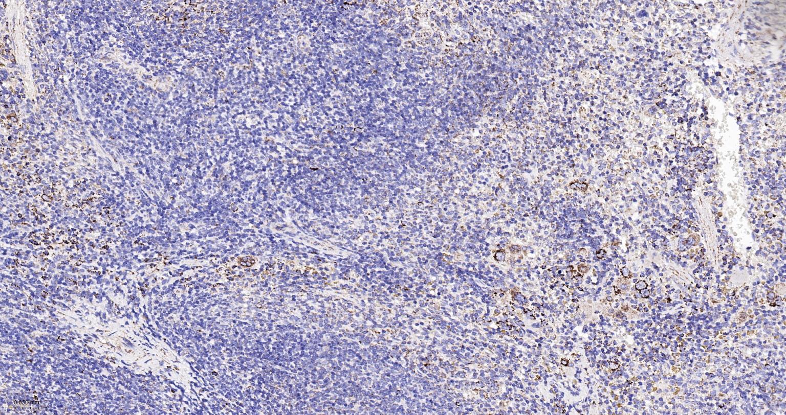 热休克蛋白-60/groEL重组兔单抗-bsm-61183R