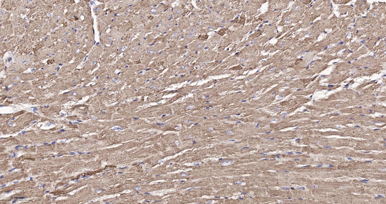 热休克蛋白-60/groEL重组兔单抗-bsm-61183R
