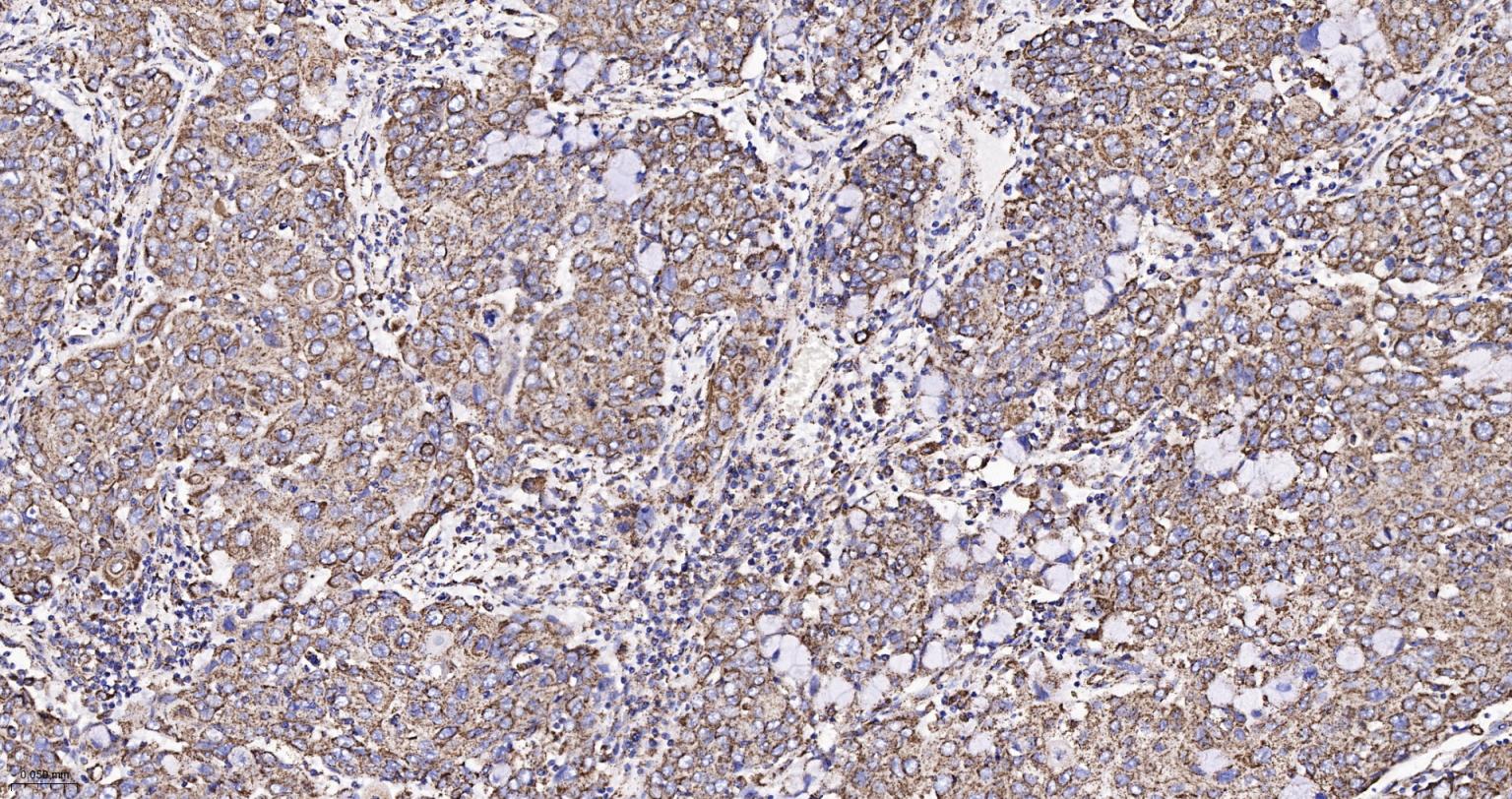 热休克蛋白-60/groEL重组兔单抗-bsm-61183R