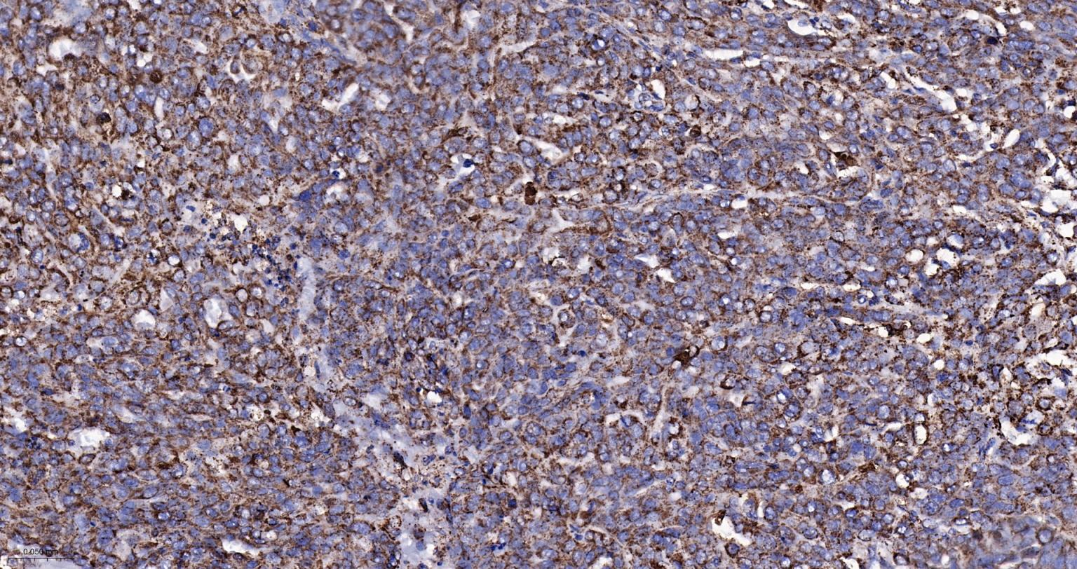 热休克蛋白-60/groEL重组兔单抗-bsm-61183R