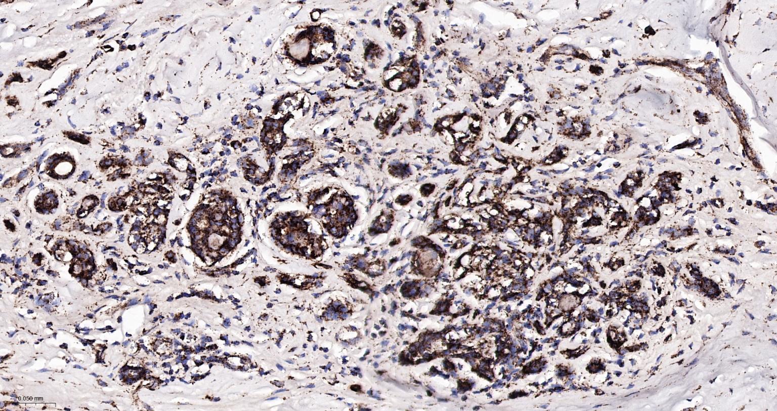 热休克蛋白-60/groEL重组兔单抗-bsm-61183R