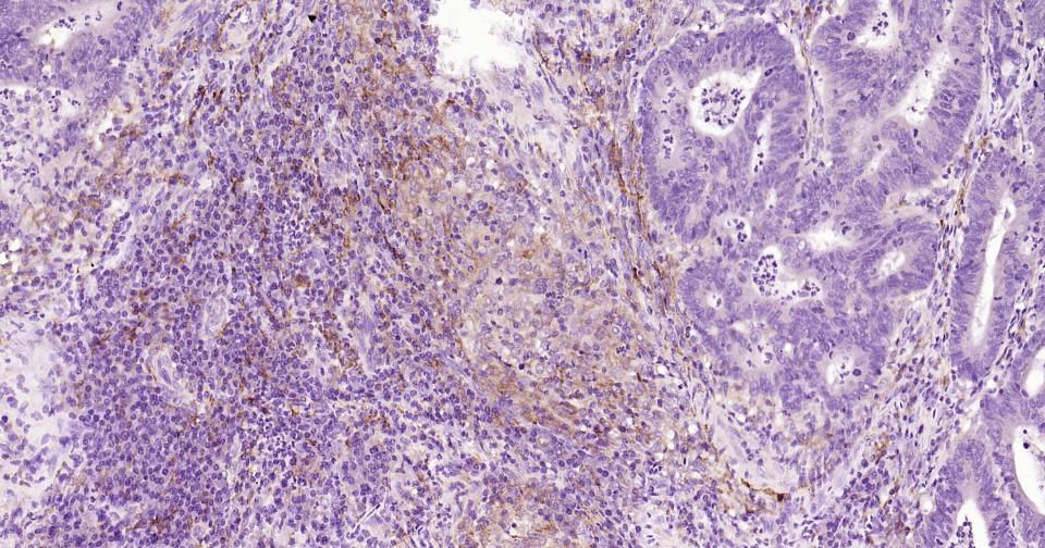 CD163重组兔单抗-bsm-63033R