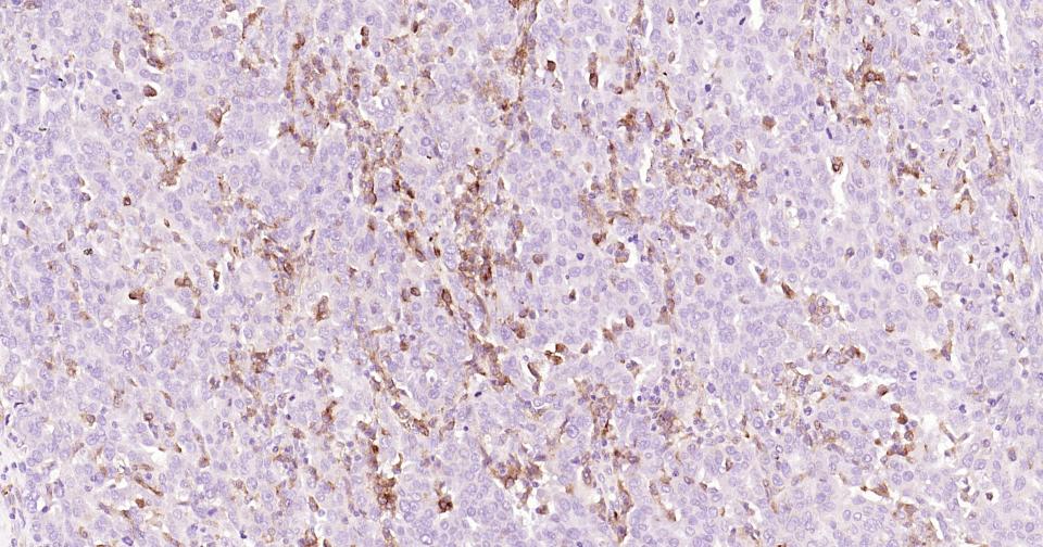 CD163重组兔单抗-bsm-63033R