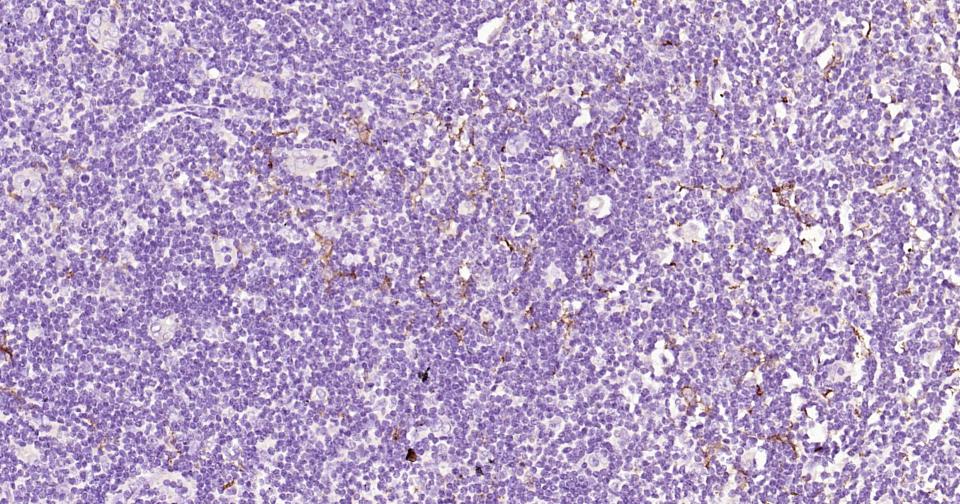 CD163重组兔单抗-bsm-63033R
