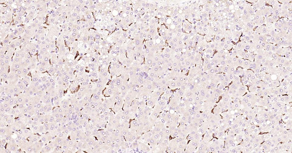 CD163重组兔单抗-bsm-63033R