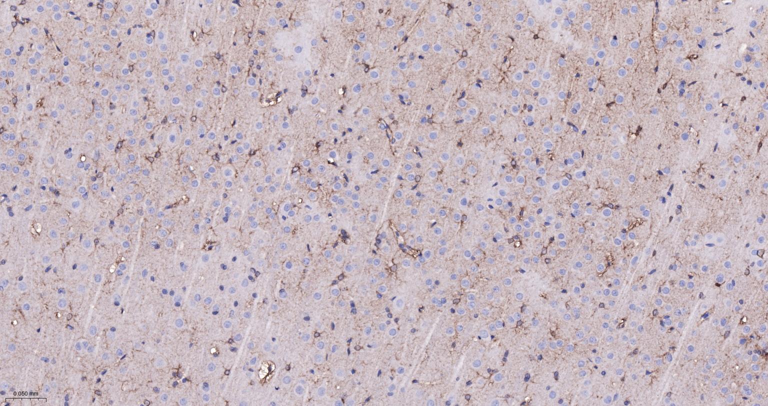 脑源神经营养因子重组兔单抗-bsm-52368R