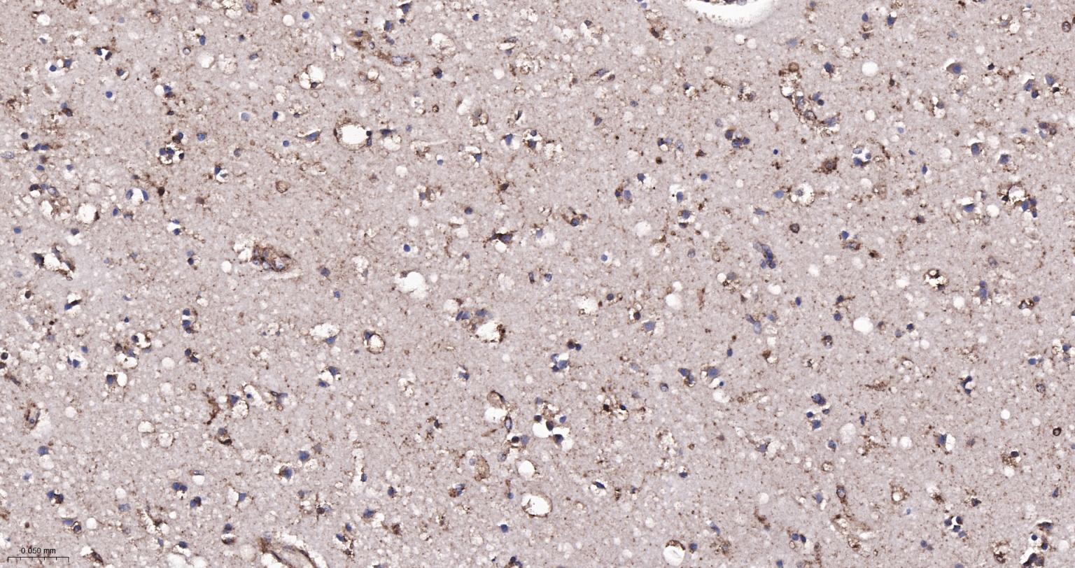 脑源神经营养因子重组兔单抗-bsm-52368R