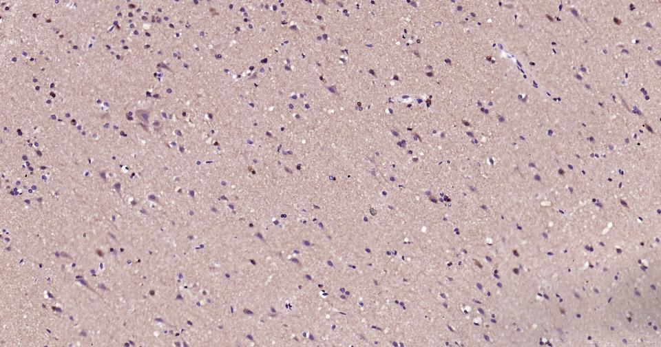 线粒体促凋亡蛋白重组兔单抗-bsm-61284R