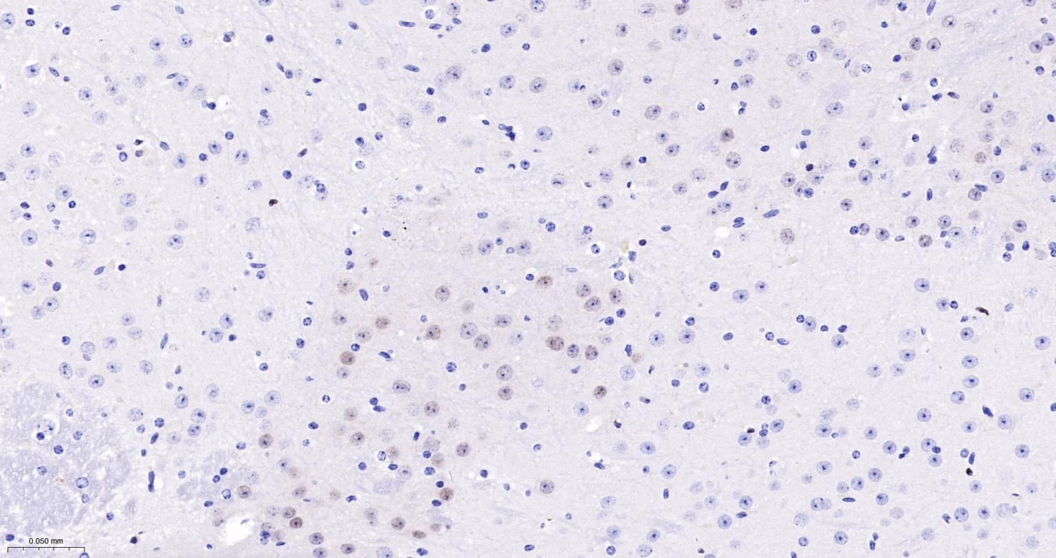 周期素D1重组兔单抗-bsm-52046R