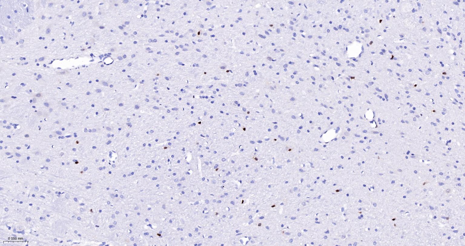 周期素D1重组兔单抗-bsm-52046R