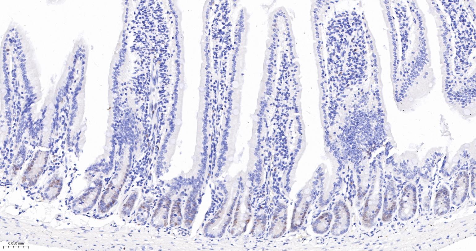 周期素D1重组兔单抗-bsm-52046R