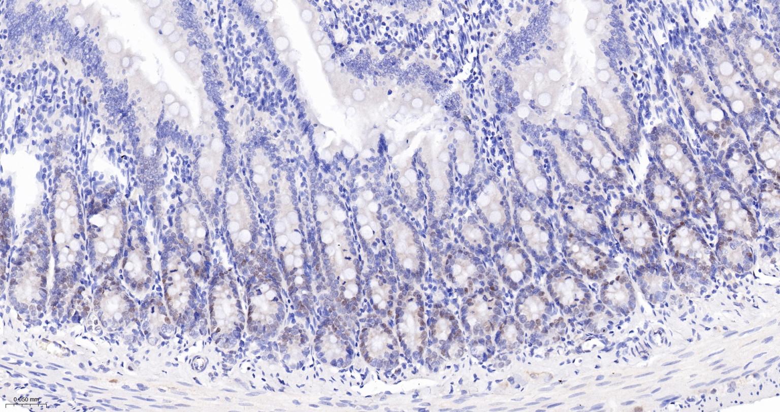 周期素D1重组兔单抗-bsm-52046R