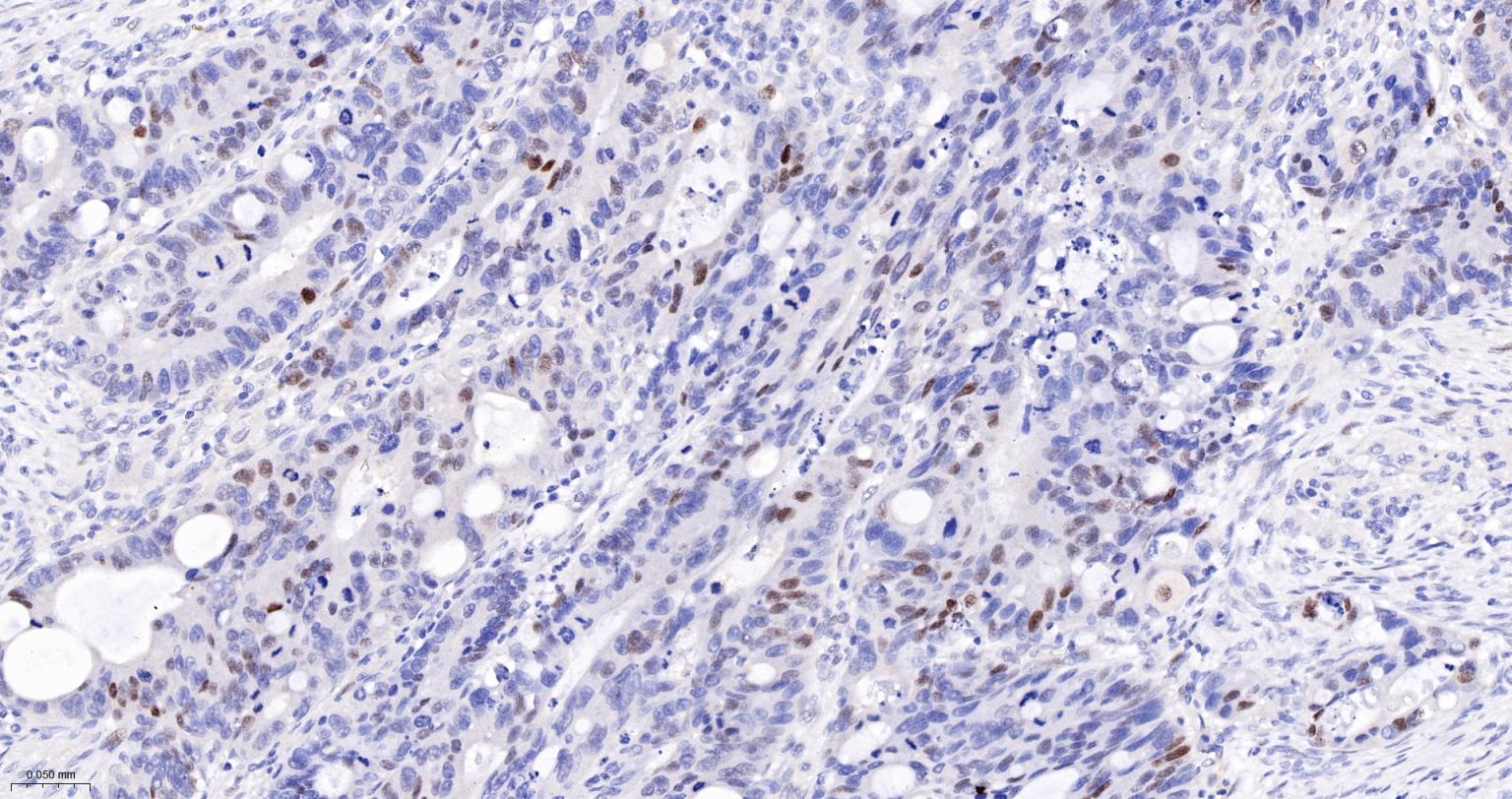 周期素D1重组兔单抗-bsm-52046R