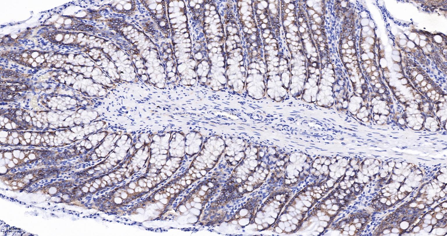 整合素α2（CD49b）重组兔单抗-bsm-52613R