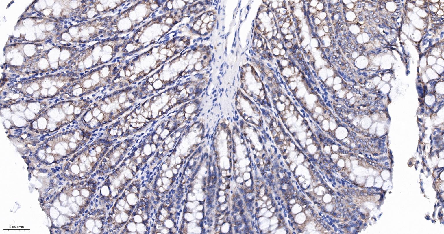 整合素α2（CD49b）重组兔单抗-bsm-52613R