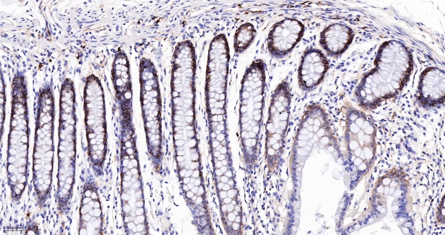 整合素α2（CD49b）重组兔单抗-bsm-52613R