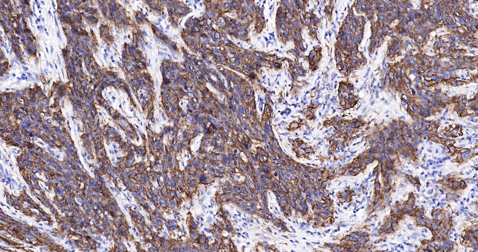 整合素α2（CD49b）重组兔单抗-bsm-52613R