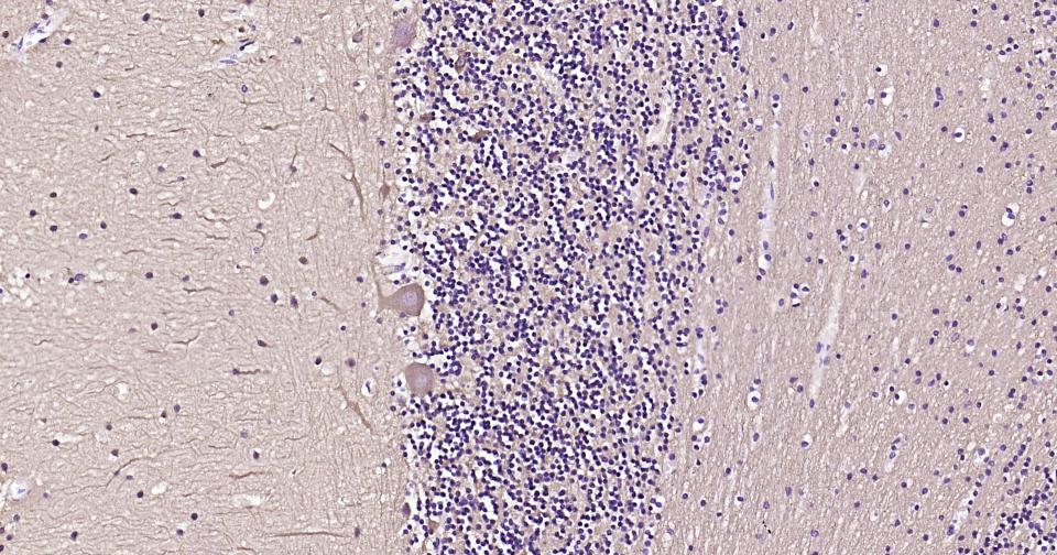 微管蛋白β3重组兔单抗-bsm-52323R