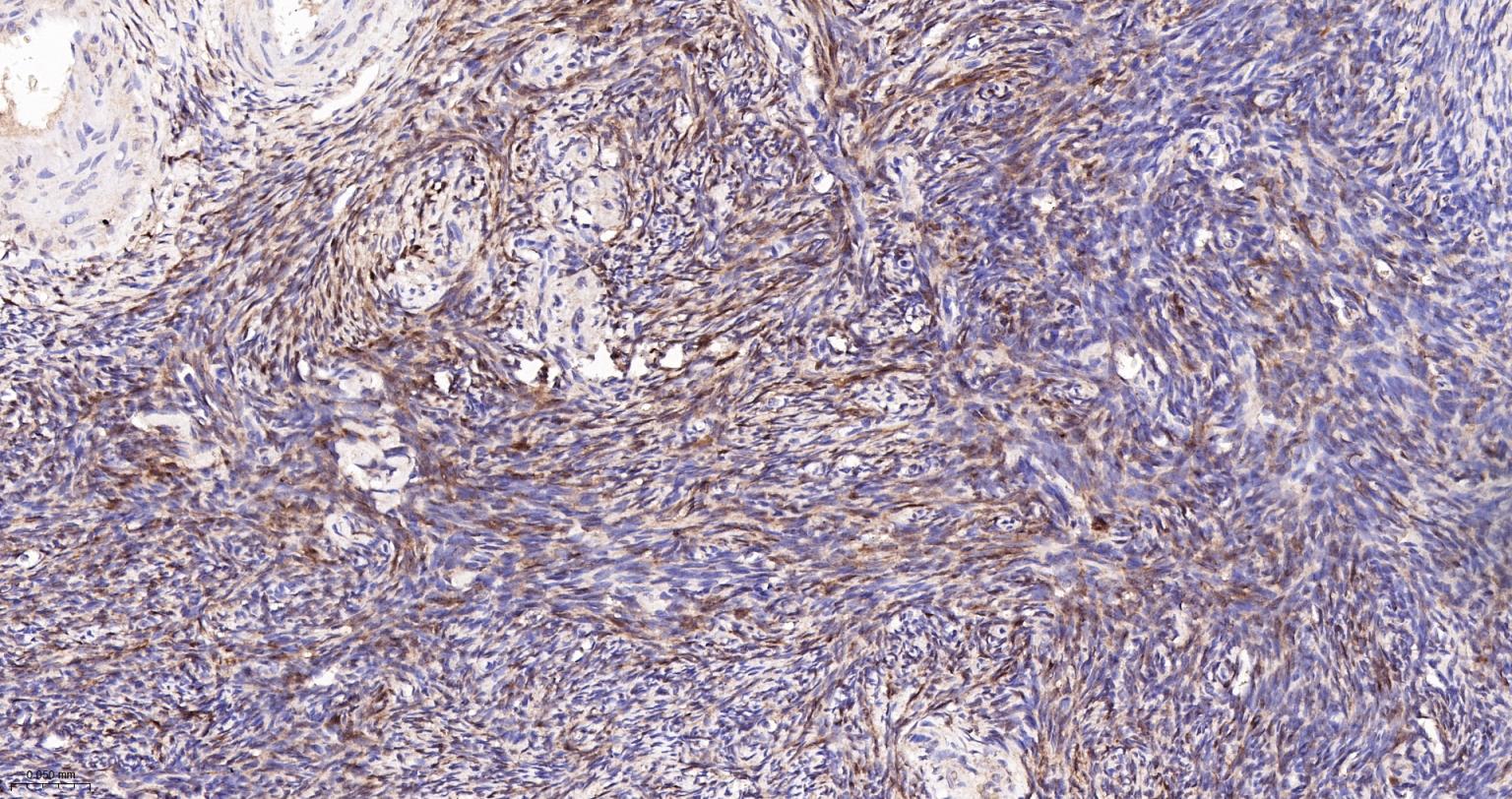 半乳糖凝集素3重组兔单抗-bsm-61087R