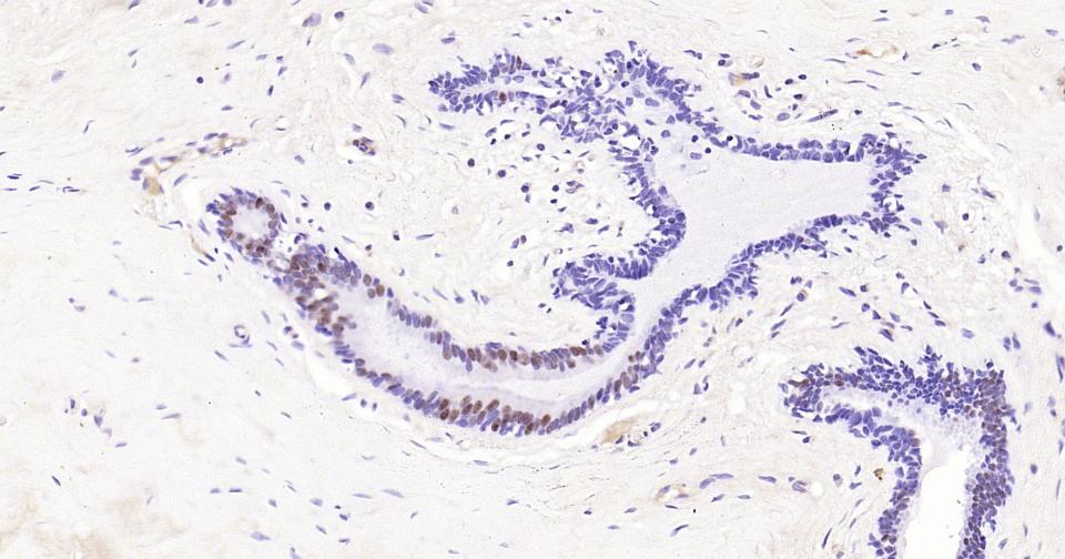 雄激素受体重组兔单抗-bsm-61204R