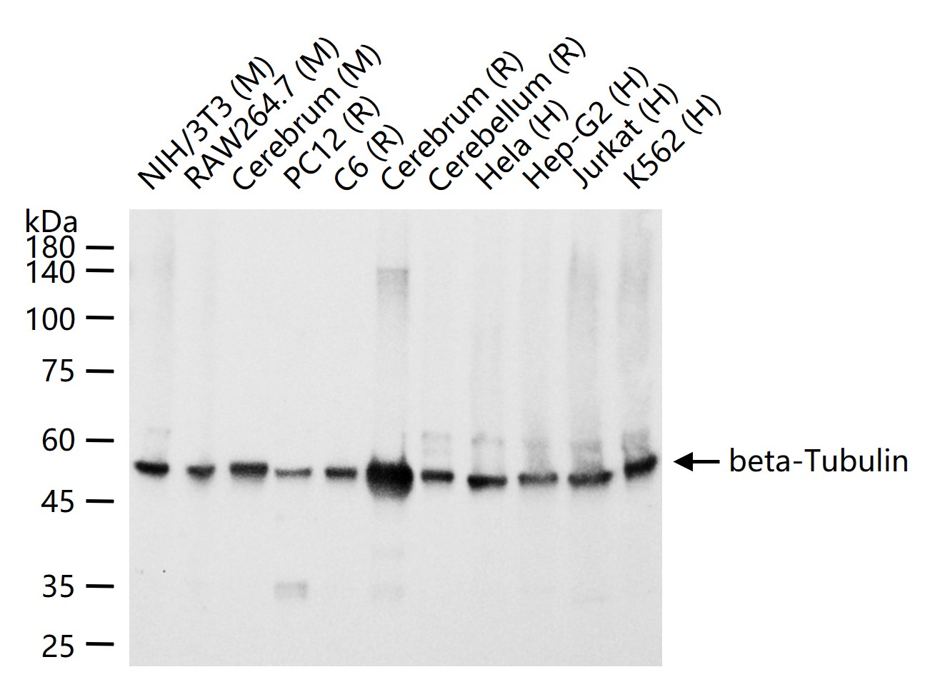 微管蛋白β tubulin(内参)单克隆抗体-bsm-33041M