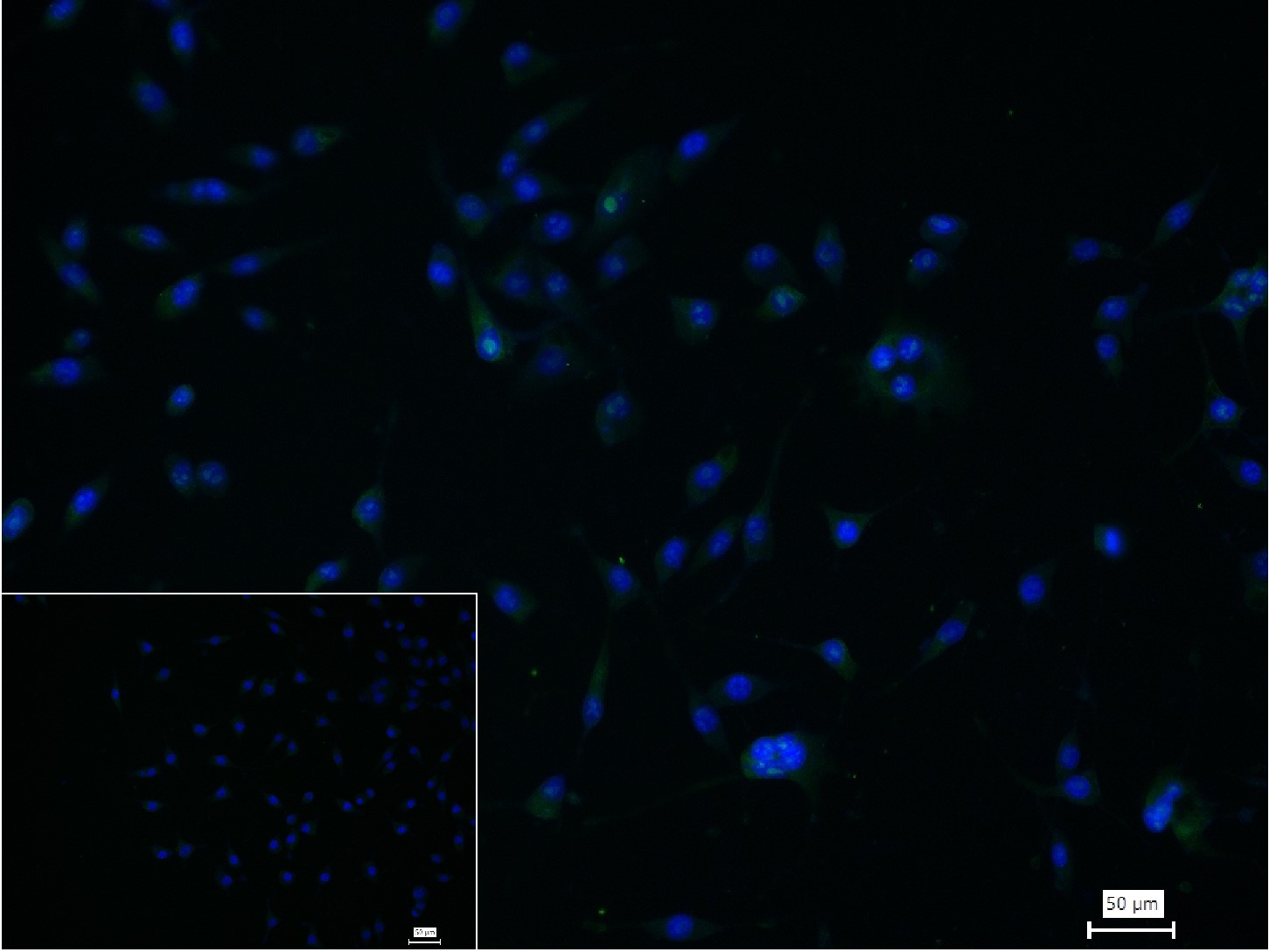 DNA甲基转移酶-3α重组兔单抗-bsm-61213R