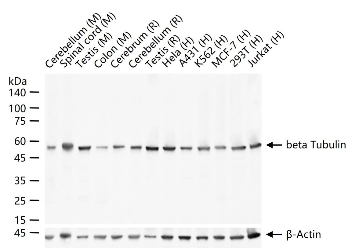 微管蛋白β tubulin/Tubulin β（内参）单克隆抗体-bsm-31105M