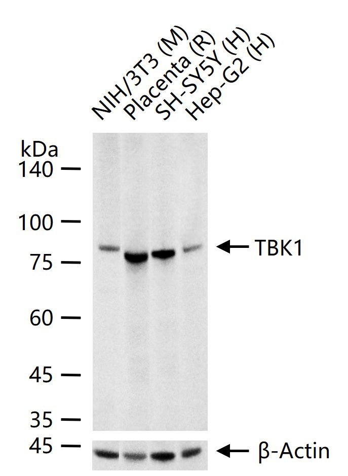 NF-κB活化激酶重组兔单抗-bsm-60750R